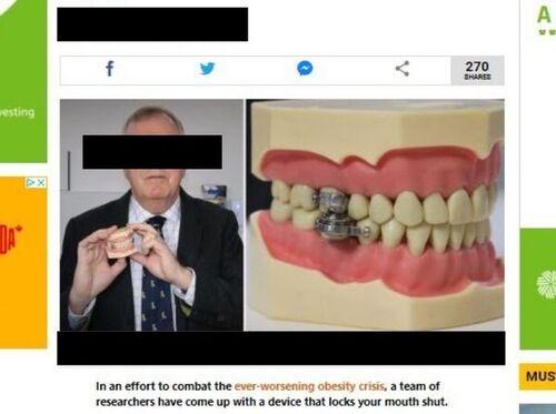 A photo from a news site showing a jaw-locking device on a false set of teeth. Jaw Locker Worst Ways to Lose Weight